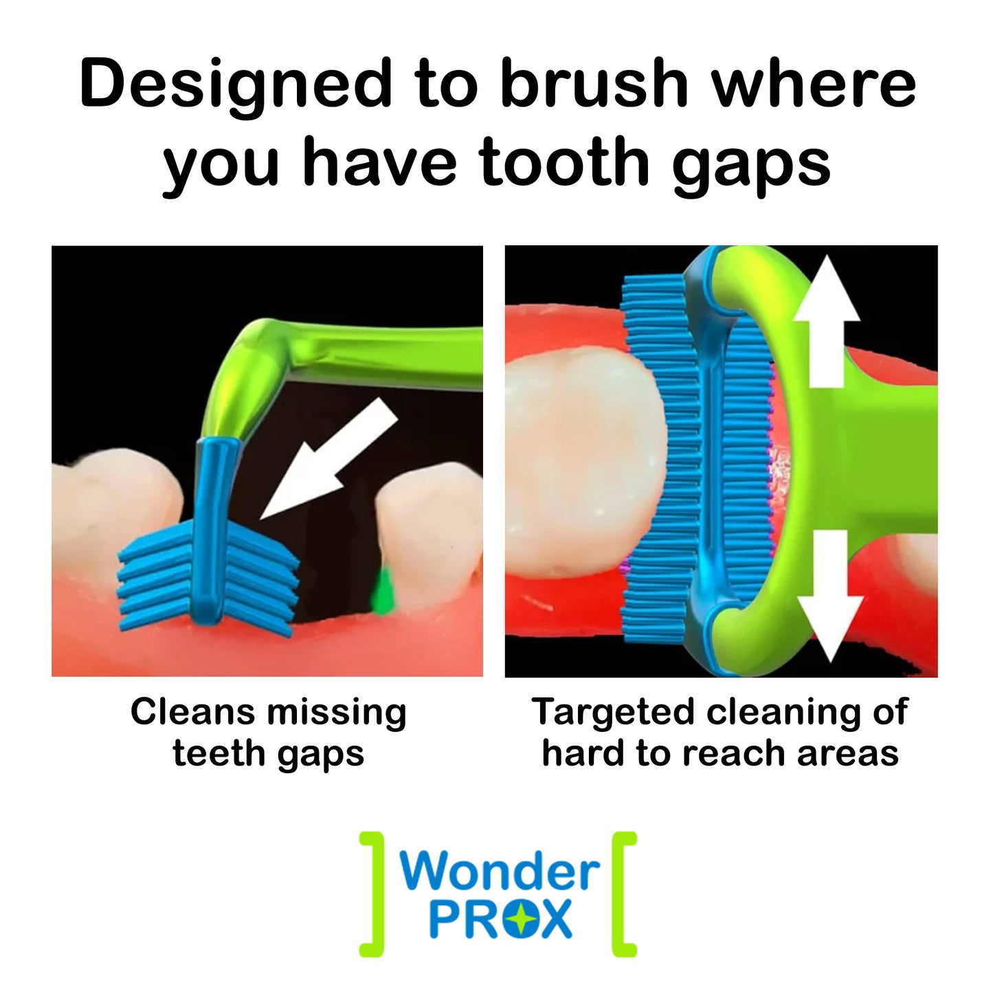 WonderProx Specialty Toothbrush | 2 Pack