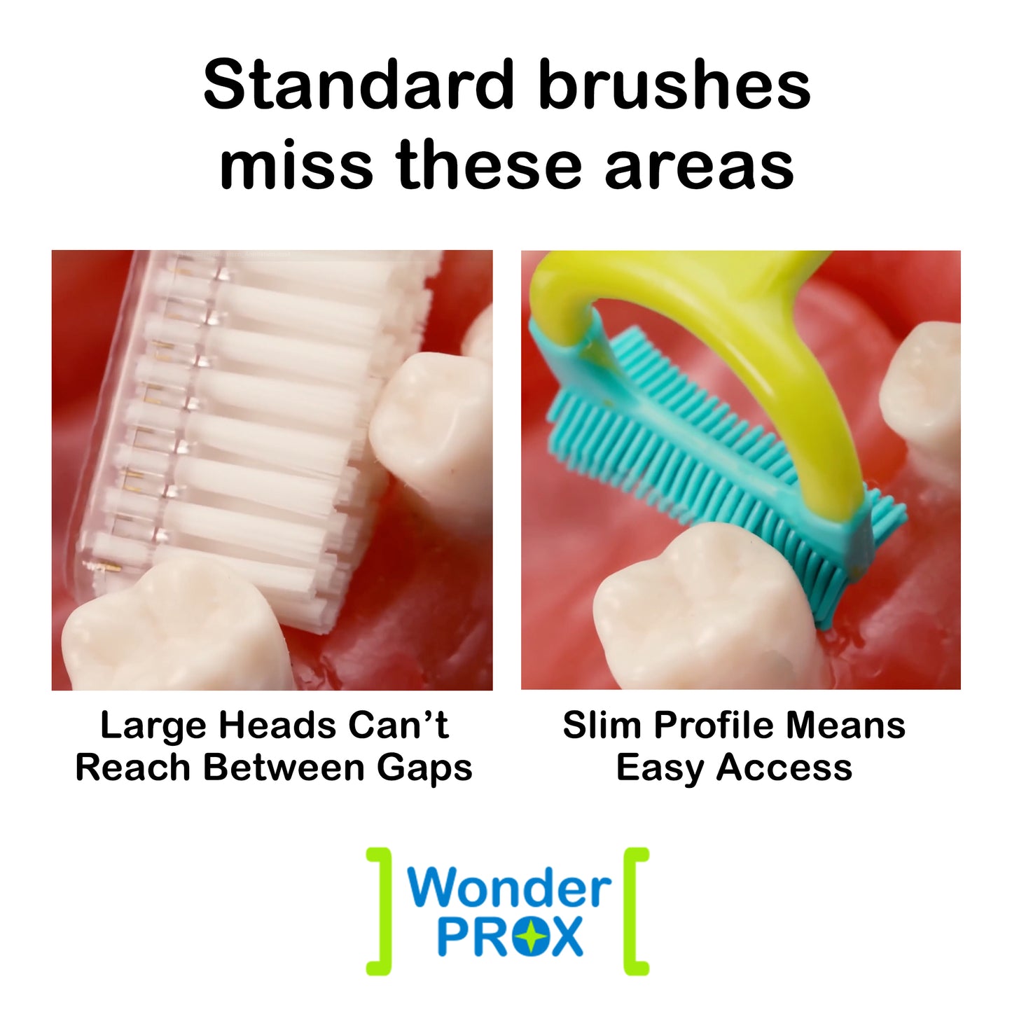 WonderProx Specialty Toothbrush | 2 Pack
